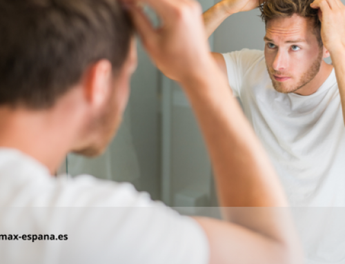 Como esconder a entrada de cabelo?