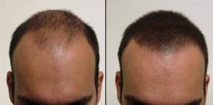 disimular las entradas