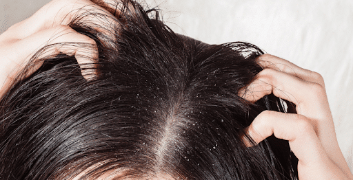 cuero cabelludo sano