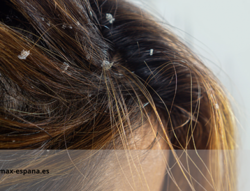 Todas as chaves para coceira no couro cabeludo