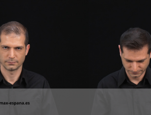 Cubra as entradas com fibras capilares Kmax