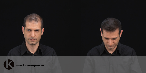 Tapar las entradas con fibras capilares kmax