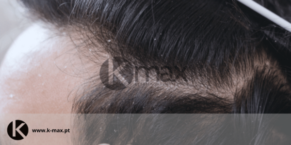 5 dicas para o couro cabeludo