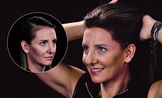 resultado-fibras-capilares-en-mujeres