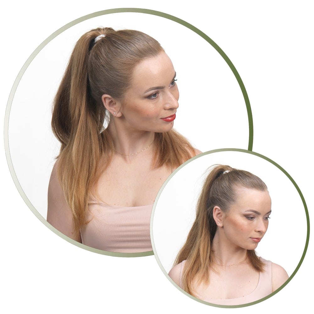 Mulher_Antes e depois de utilizar as fibras capilares Kmax