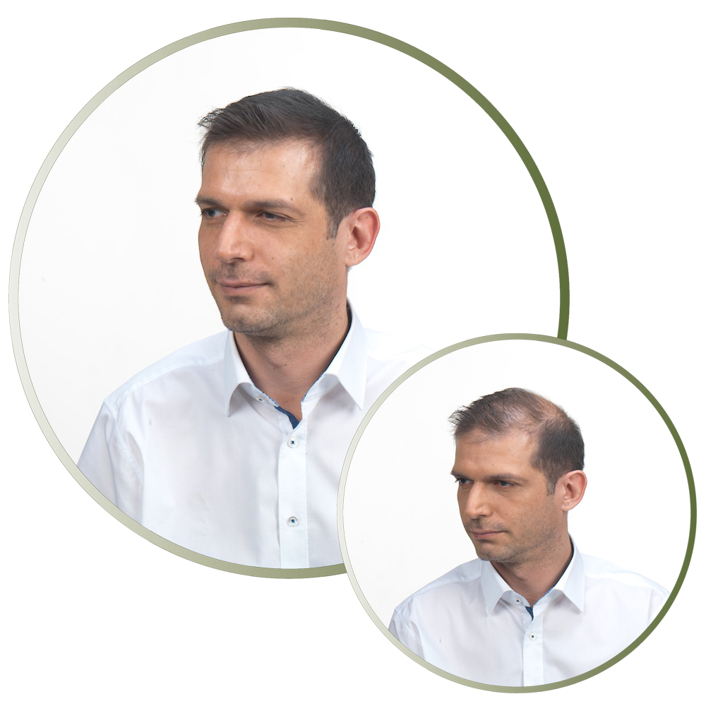 Como funcionam as fibras capilares nos homens 