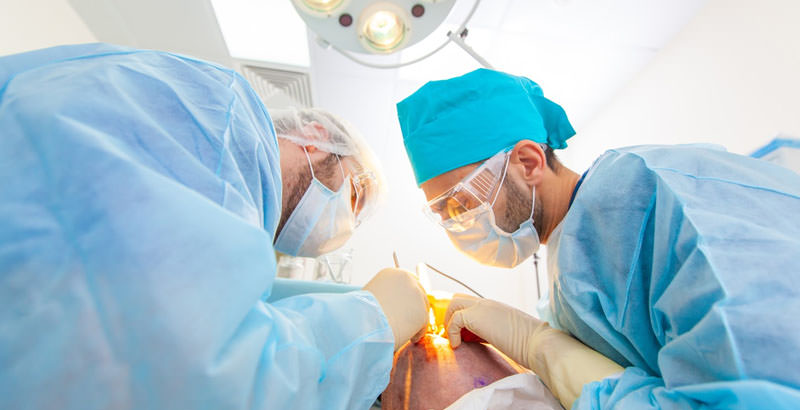 Equipa de cirurgiões numa operação de transplante capilar